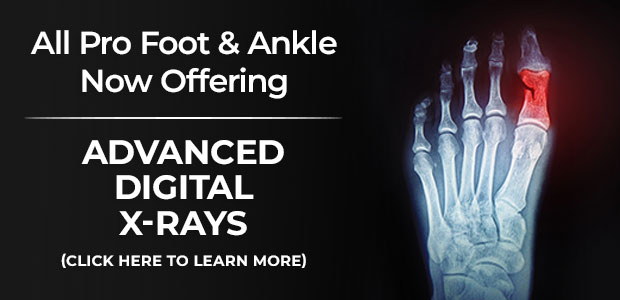 Digital X-Ray Banner