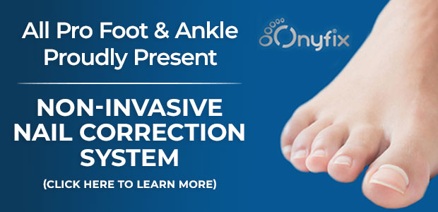 Onyfix Nail Correction System Banner