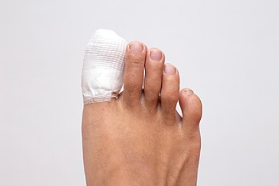 Managing a Broken Toe